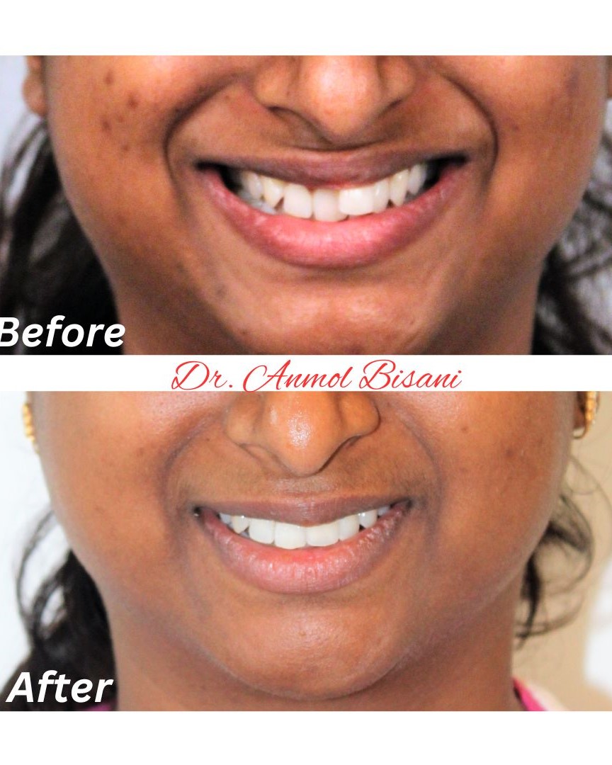 WhatsApp Image 2023-12-15 at 18.17.50_a427a997